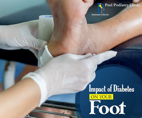 Impact of Diabetes on Foot