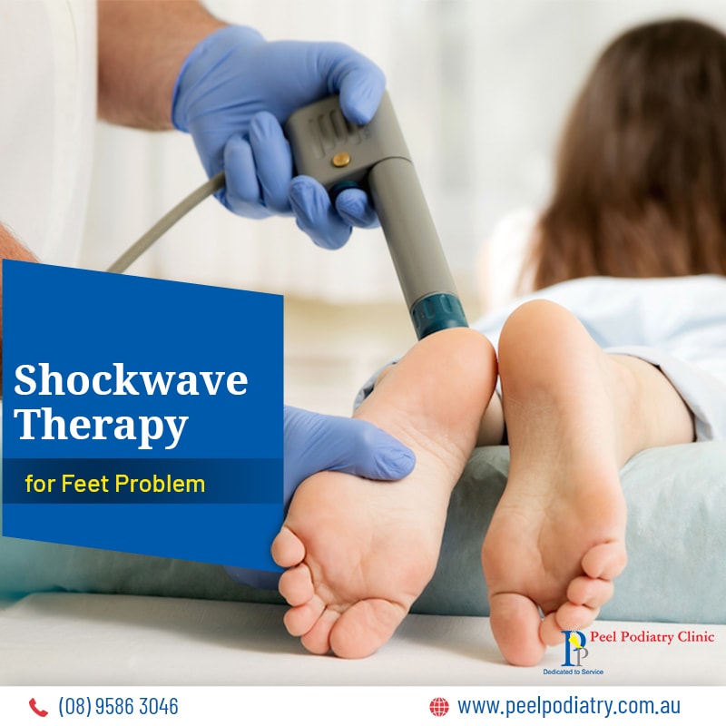 Shockwave therapy Mandurah
