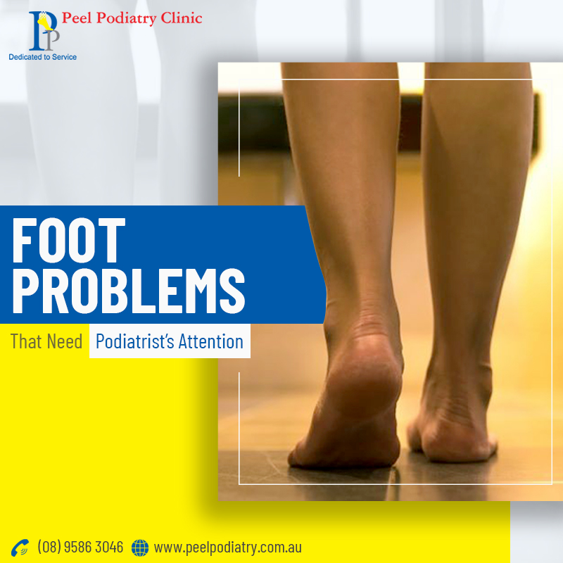 6 Foot Problems that Require a Podiatrist’s Mediation