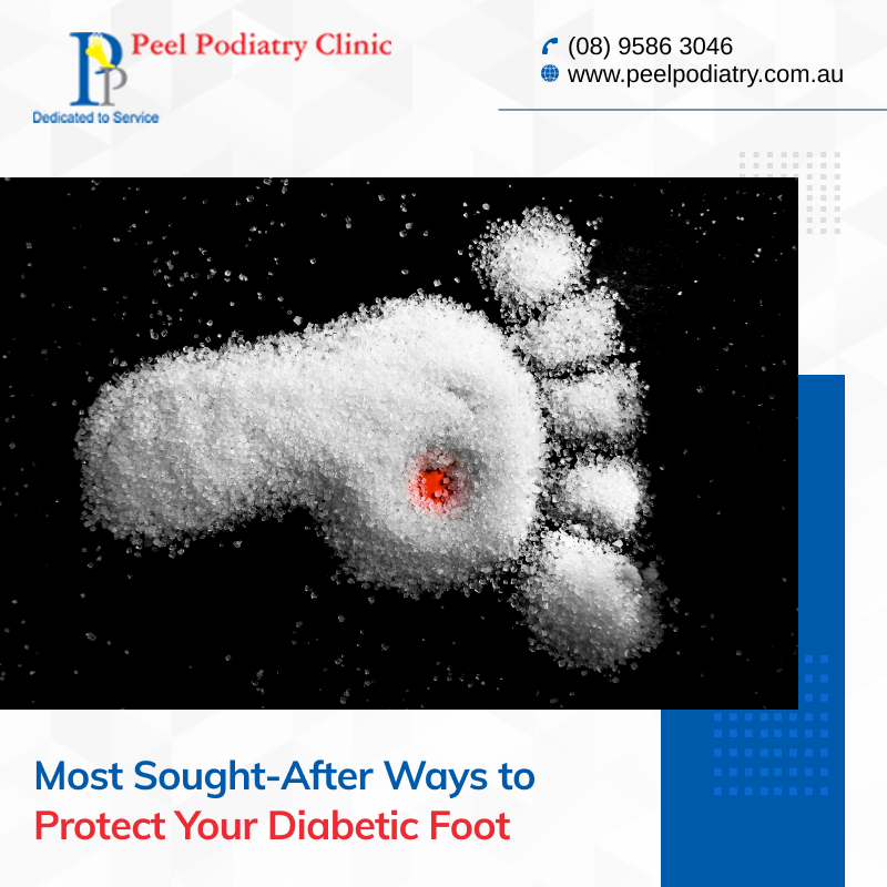 What are the Best Ways to Take Care of Your Diabetic Foot?