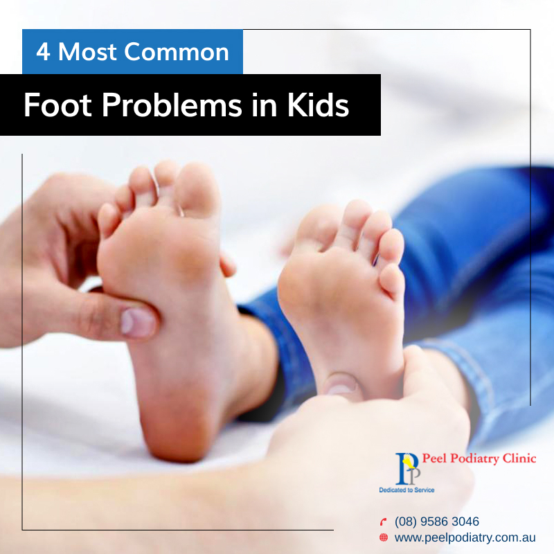 What are the Most Common Foot Problems in Children?
