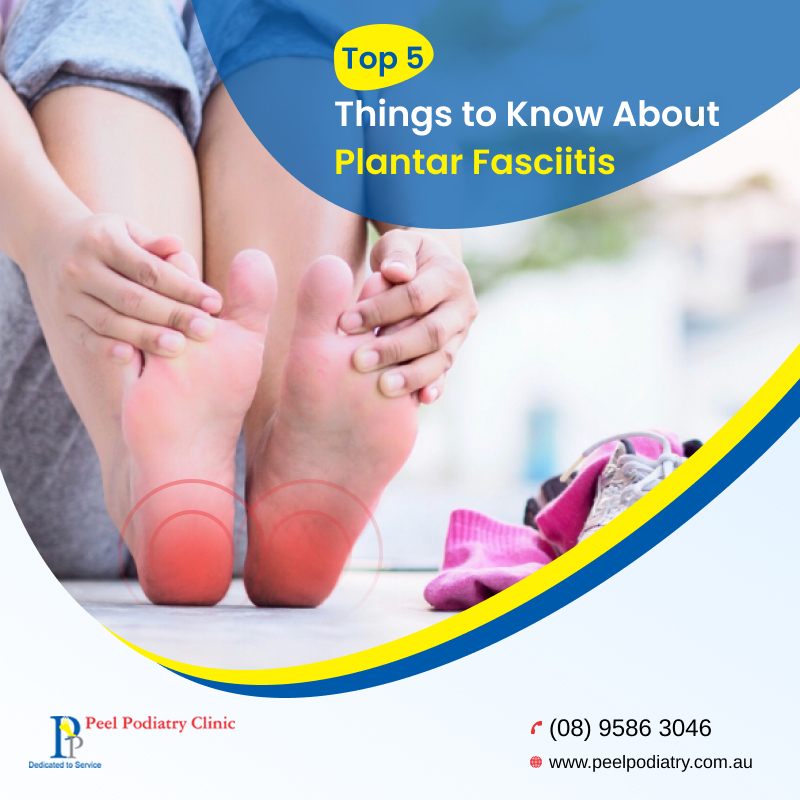 Top 5Things to Know About Plantar Fasciitis